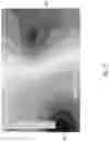 Fig. 12 - Protective respirator utilizing far UV-C irradiation
