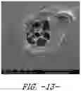 Fig. 12 - WOUND CARE DEVICE HAVING FLUID TRANSFER AND ADHESIVE PROPERTIES