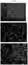 Fig. 05 - Non-cultured, partially digested, cryopreserved cartilage product
