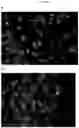 Fig. 08 - Non-cultured, partially digested, cryopreserved cartilage product