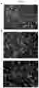 Fig. 09 - Non-cultured, partially digested, cryopreserved cartilage product