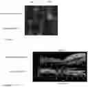 Fig. 13 - BICOMPONENT FIBER-BASED SCAFFOLDS FOR MULTIPLE TISSUE JUNCTION REGENERATION