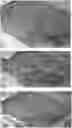 Fig. 01 - DECELLULARIZED PLACENTAL MEMBRANE AND METHODS OF PREPARING AND USE THEREOF