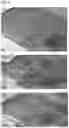 Fig. 04 - DECELLULARIZED PLACENTAL MEMBRANE AND METHODS OF PREPARING AND USE THEREOF