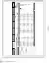 Fig. 77 - Home renal therapy system and machine