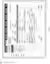 Fig. 80 - Home renal therapy system and machine