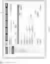 Fig. 82 - Home renal therapy system and machine