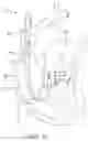Fig. 10 - DUAL LUMEN DRAINAGE CANNULA WITH SINGLE OUTLET