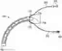 Fig. 01 - Irrigating intraluminal suction inner cannula system