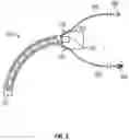 Fig. 04 - Irrigating intraluminal suction inner cannula system