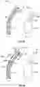 Fig. 07 - Irrigating intraluminal suction inner cannula system