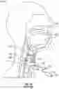 Fig. 10 - Irrigating intraluminal suction inner cannula system