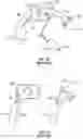 Fig. 11 - Irrigating intraluminal suction inner cannula system