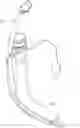 Fig. 01 - Endotracheal Tube
