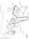 Fig. 02 - RESPIRATORY PRESSURE THERAPY SYSTEM