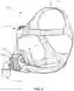Fig. 04 - RESPIRATORY PRESSURE THERAPY SYSTEM