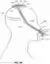 Fig. 09 - RESPIRATORY PRESSURE THERAPY SYSTEM