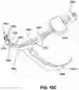 Fig. 38 - RESPIRATORY PRESSURE THERAPY SYSTEM