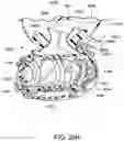Fig. 74 - RESPIRATORY PRESSURE THERAPY SYSTEM