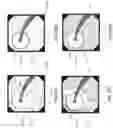 Fig. 26 - Systems, devices and methods for performing medical procedures in the intestine