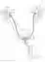 Fig. 01 - Coated Urinary Catheter or Ureteral Stent and Method