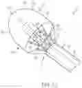 Fig. 09 - Coated Urinary Catheter or Ureteral Stent and Method