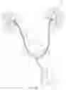 Fig. 20 - Coated Urinary Catheter or Ureteral Stent and Method