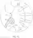 Fig. 25 - Coated Urinary Catheter or Ureteral Stent and Method