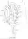 Fig. 63 - Coated Urinary Catheter or Ureteral Stent and Method