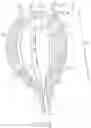 Fig. 64 - Coated Urinary Catheter or Ureteral Stent and Method