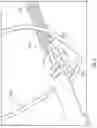 Fig. 07 - Modular pre-loaded medical implants and delivery systems