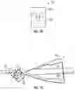 Fig. 05 - Catheter system with guidewire advancement element