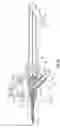 Fig. 06 - Catheter system with guidewire advancement element
