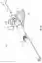 Fig. 12 - Catheter system with guidewire advancement element