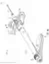 Fig. 18 - Catheter system with guidewire advancement element