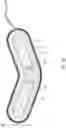 Fig. 05 - APPARATUS AND METHOD FOR INACTIVATING INFECTIOUS ORGANISMS IN HUMAN BODY