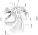 Fig. 07 - APPARATUS AND METHOD FOR INACTIVATING INFECTIOUS ORGANISMS IN HUMAN BODY