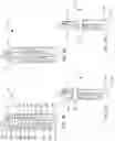 Fig. 04 - Systems for delivering implantable devices across an atrial septum