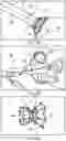 Fig. 12 - Systems for delivering implantable devices across an atrial septum