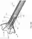 Fig. 33 - Systems for delivering implantable devices across an atrial septum