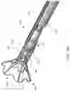 Fig. 35 - Systems for delivering implantable devices across an atrial septum
