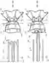 Fig. 40 - Systems for delivering implantable devices across an atrial septum
