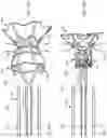 Fig. 41 - Systems for delivering implantable devices across an atrial septum
