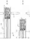 Fig. 42 - Systems for delivering implantable devices across an atrial septum