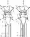 Fig. 45 - Systems for delivering implantable devices across an atrial septum