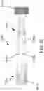 Fig. 49 - Systems for delivering implantable devices across an atrial septum
