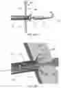 Fig. 57 - Systems for delivering implantable devices across an atrial septum