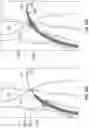 Fig. 65 - Systems for delivering implantable devices across an atrial septum