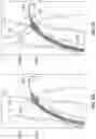 Fig. 66 - Systems for delivering implantable devices across an atrial septum