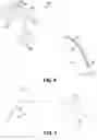 Fig. 09 - Endoscopic balloon dilator systems